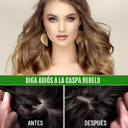 ACEITE DE BATANA PROMOCIÓN 2X1  – Reparación profunda, crecimiento fortalecido y brillo natural para todo tipo de cabello