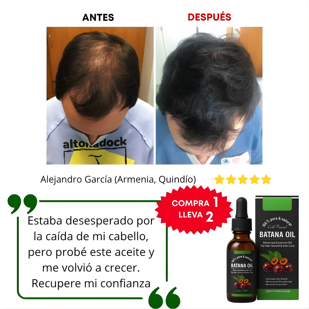 ACEITE DE BATANA PROMOCIÓN 2X1  – Reparación profunda, crecimiento fortalecido y brillo natural para todo tipo de cabello